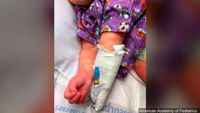 Two Colorado children dead from inflammatory illness linked to coronavirus