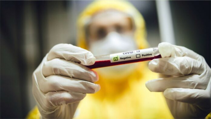 Blood test may determine coronavirus patients’ severity of illness, risk of death: study